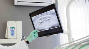 Hygienist pointing at dental x-ray